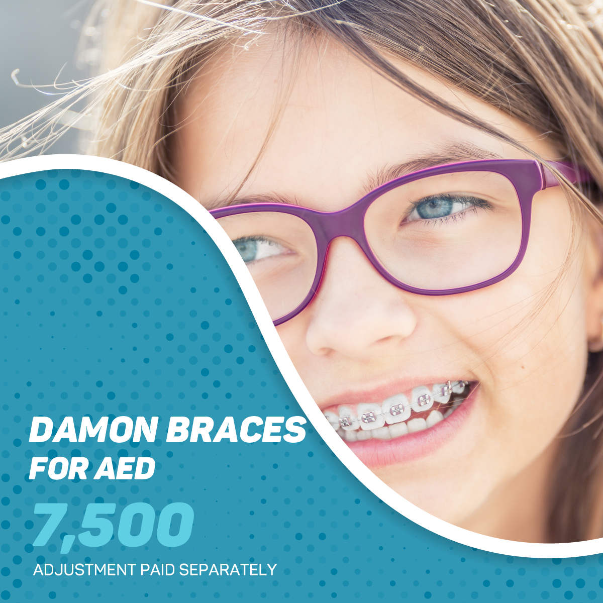 Dubai Braces True Smile Works